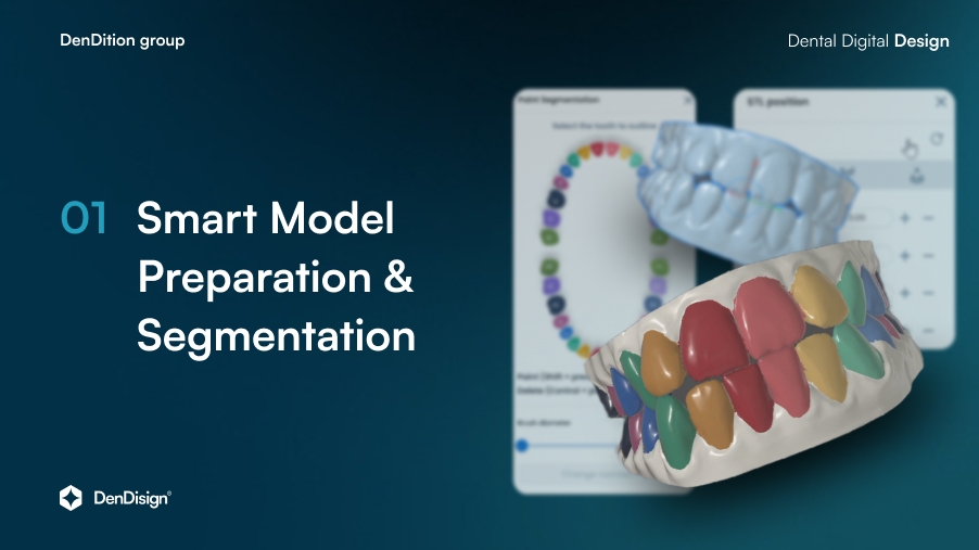 Segmentation