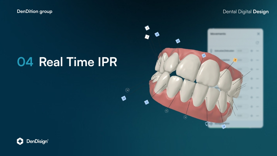 Real time IPR