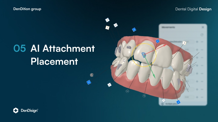 AI attachment placement