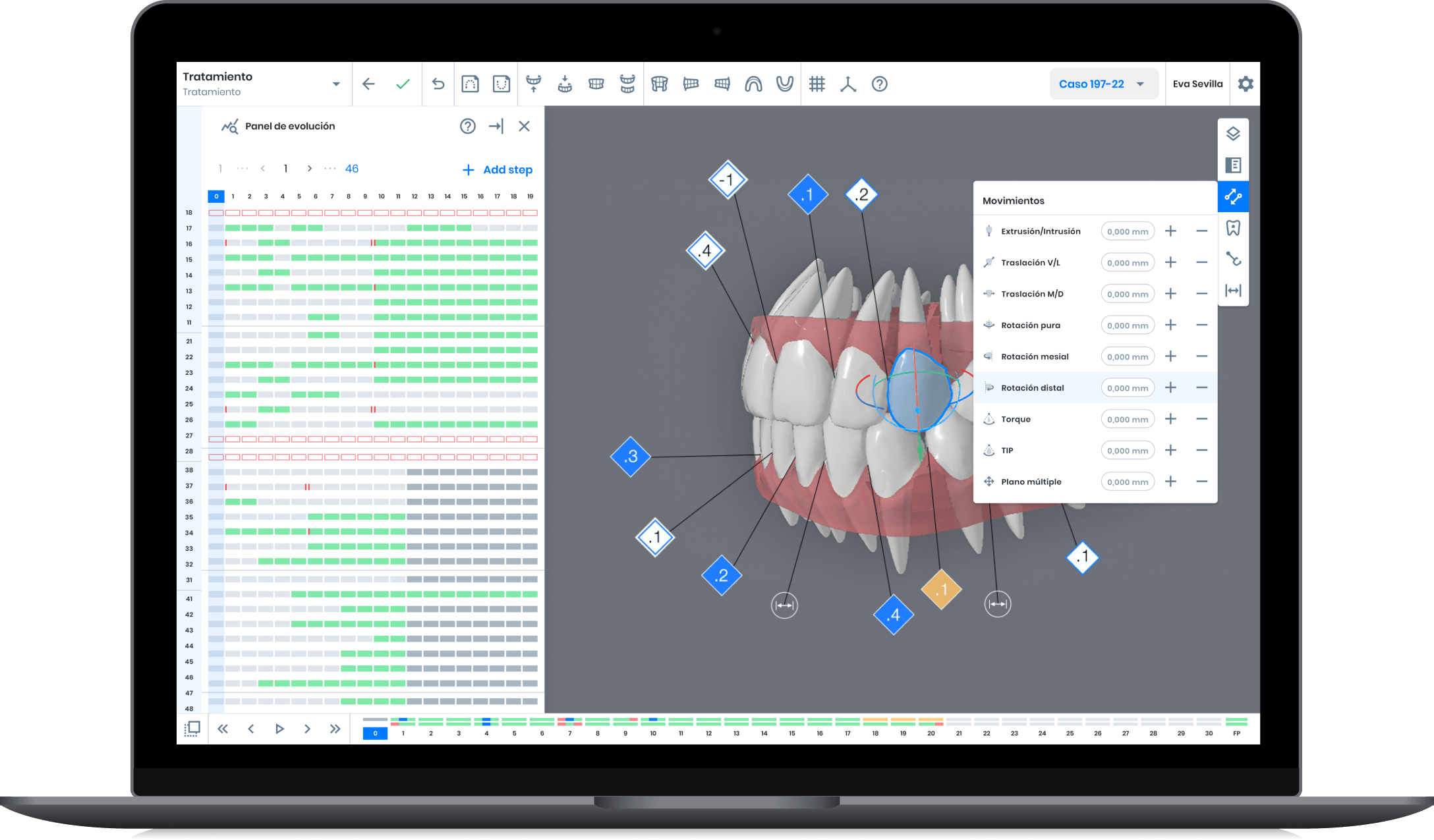 Demo for Dendisign laptop